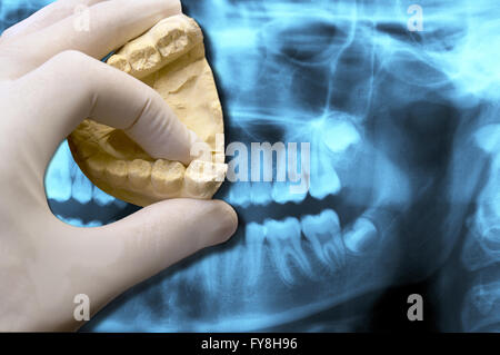 Dentiste montrant une molaire sur la radiographie dentaire panoramique Banque D'Images