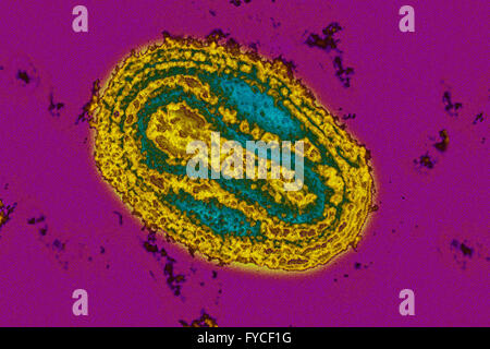 VIRUS DE LA SHARKA, TEM Banque D'Images