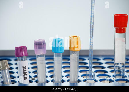 Tube à essai pour l'analyse de virus ZIKA Banque D'Images