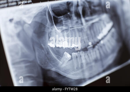 Gros plan des rayons x Banque D'Images