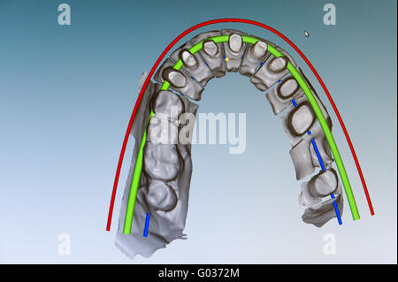 Représentation de la mâchoire supérieure sur le modèle monit Banque D'Images