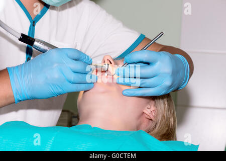 Close-up of young female ayant ses dents guérie Banque D'Images