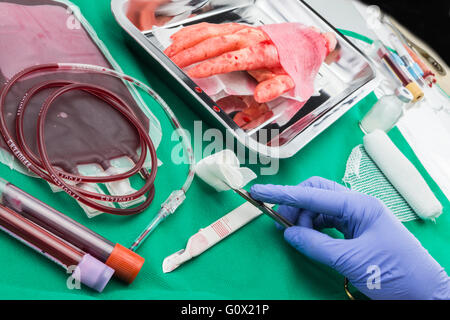 Unité de concentré de globules rouges du sang, la greffe de membre supérieur, dans une salle d'opération Banque D'Images