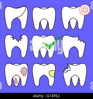 Ensemble de dents pourries et sain Banque D'Images