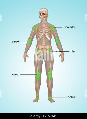 Illustration montrant les lieux communs de la douleur et l'inflammation dans le squelette humain. La douleur articulaire est représenté en vert dans l'épaule, coude, hanche, genou, et la cheville. Banque D'Images