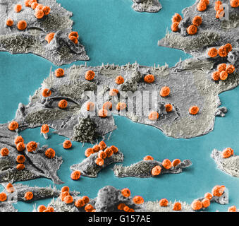 L'analyse des électrons Microphotographie (SEM) montrant les cellules immunitaires (petite sphericals, rouge) attaquer des cellules cancéreuses (les grandes étendues, gris). Inconnu d'agrandissement. Banque D'Images