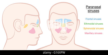 Sinus paranasaux sur un visage masculin en différentes couleurs - frontaux, ethmoidal sphénoïdales, maxillaire et sinus. Banque D'Images