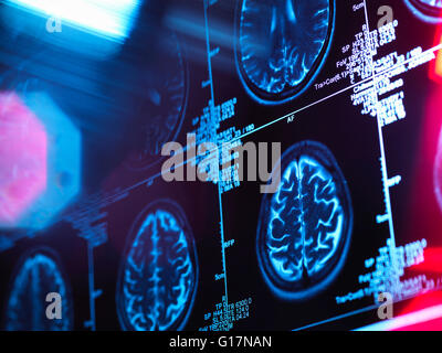 Scan du cerveau humain dans une clinique de neurologie Banque D'Images