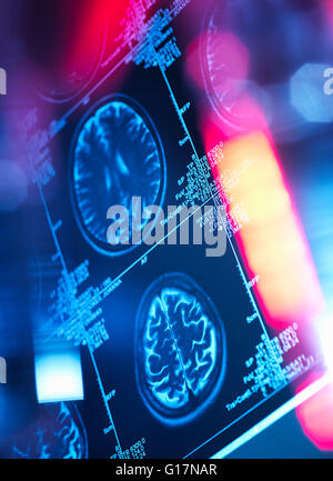 Scan du cerveau humain dans une clinique de neurologie Banque D'Images