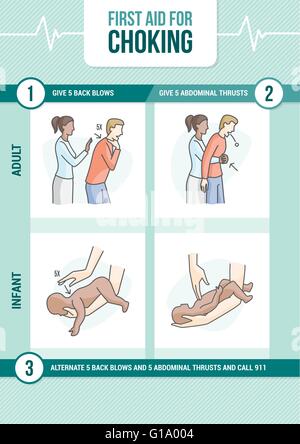 Procédure de premiers secours pour l'étouffement et la manœuvre de Heimlich pour adultes et enfants Illustration de Vecteur