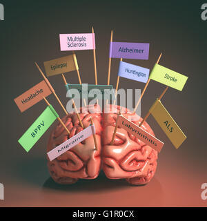 Image d'un cerveau sur la table avec diverses plaques nominatives de diverses maladies qui peuvent affecter notre cerveau. C'est une image 3D avec namepl Banque D'Images