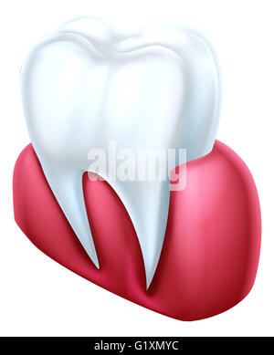 Une illustration médicale en coupe dentaire d'une dent et la gencive Banque D'Images