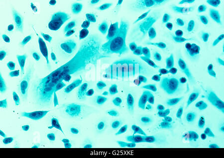 Des PC-3, les cellules du cancer de la prostate avec vitraux, sous le bleu de Coomassie inductances de microscope à contraste d'interférence. Banque D'Images