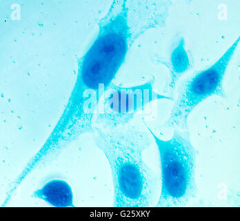 Des PC-3, les cellules du cancer de la prostate avec vitraux, sous le bleu de Coomassie inductances de microscope à contraste d'interférence. Banque D'Images