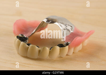 Nouveau dentier avec les couronnes en céramique-métal se coucher sur une table en bois Banque D'Images