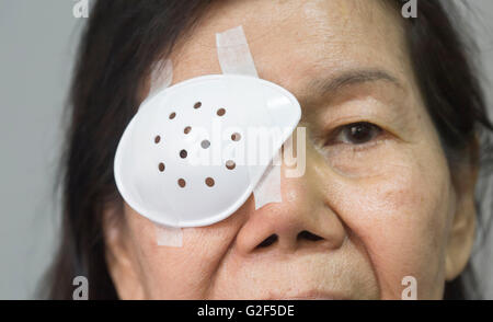 Protection oculaire couvrant senior woman après chirurgie de la cataracte. Banque D'Images