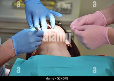 Dentiste la conduite d'une opération dans la bouche, Close up Banque D'Images