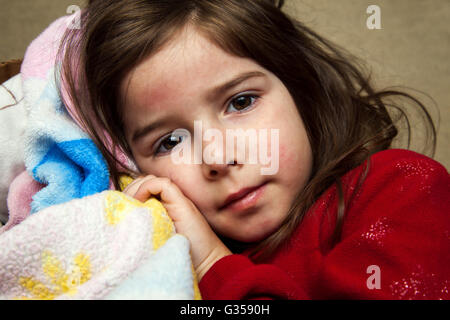 Une jeune fille avec une éruption de fièvre de câlins avec une couverture et regarde la caméra avec une expression vide. Banque D'Images