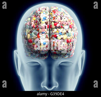 X-ray de tête humaine avec les comprimés et les médicaments pour le cerveau.. Banque D'Images