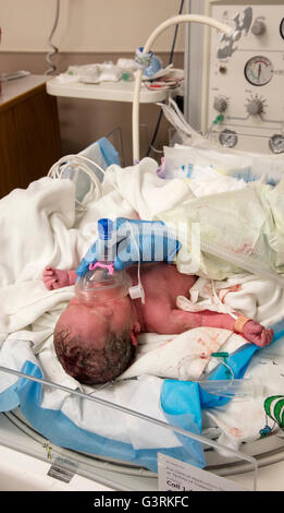 Suppression des voies respiratoires dans nouveau bébé né par césarienne, des trios de l'Hôpital général de Kennewick, Washington, USA, Tri-Cities Banque D'Images