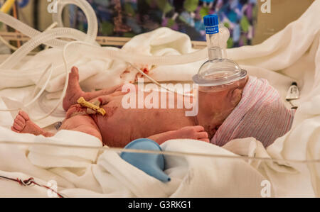Suppression des voies respiratoires dans nouveau bébé né par césarienne, des trios de l'Hôpital général de Kennewick, Washington, USA, Tri-Cities Banque D'Images