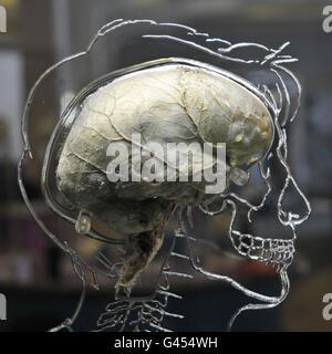 L'exposition du cerveau à Bristol Banque D'Images