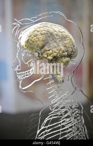 Un véritable cerveau humain suspendu en liquide avec un squelette à l'échelle, un système nerveux central et une silhouette humaine sculptés en acrylique, à l'intérieur de l'attraction scientifique @Bristol en tant que partie nouvelle exposition intitulée « All About US », qui sera ouverte au public le vendredi 11 mars. Banque D'Images
