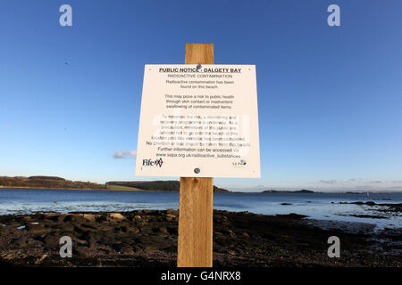 Un panneau à Dalgety Bay à Fife en tant qu'ancien Premier ministre Gordon Brown a demandé au ministère de la Défense de prendre des mesures immédiates pour traiter les particules radioactives trouvées sur la plage écossaise. Banque D'Images