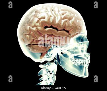 X-ray godille avec cerveau isolated on black Banque D'Images