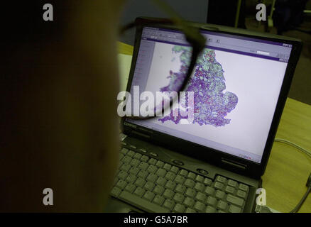 La propagation de la maladie de cartographie Banque D'Images