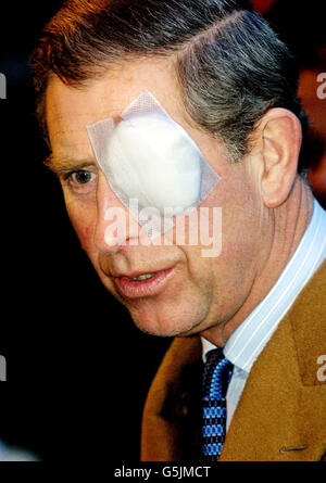 Le Prince Charles Eye Patch Banque D'Images