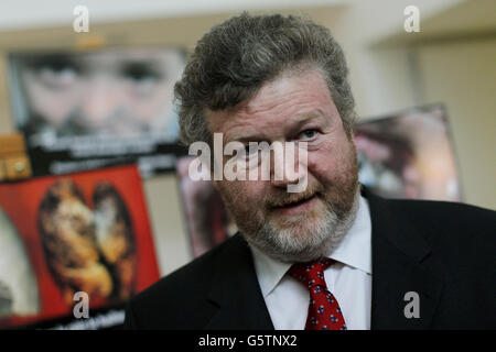 Ministre de la Santé Dr James O'Reilly avec des photographies qui apparaîtront sur l'emballage de cigarettes vendu en Irlande à la RHA Gallery, Dublin. Banque D'Images