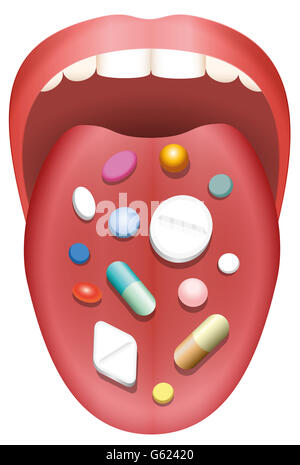 Comprimés et capsules distribuées sur un tirant la langue d'un patient. Illustration sur fond blanc. Banque D'Images