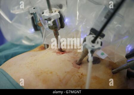 Le système chirurgical da Vinci Xi Banque D'Images