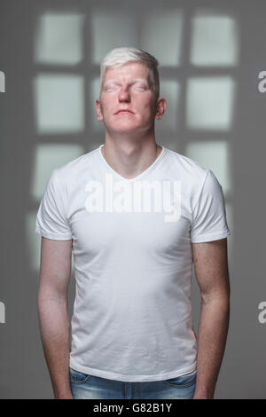 Homme albinos aux yeux clos debout contre l'arrière-plan gris Banque D'Images