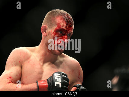 UFC Fight Night 84 - 02 Arena.Davey Grant en Grande-Bretagne avec un visage imprégné de sang dans son combat pendant la nuit de combat de l'UFC Banque D'Images