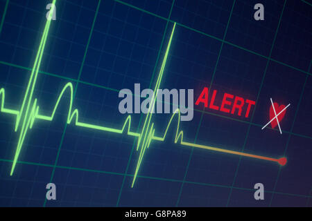 Battements cardiaques cardiogramme sur le moniteur Banque D'Images