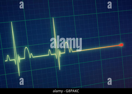 Flatline écho sur un moniteur cardiaque médical / ECG ECG (électrocardiogramme) avec fond bleu Banque D'Images