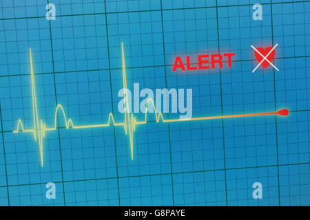 Battements cardiaques cardiogramme sur le moniteur Banque D'Images