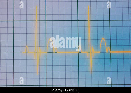 Flatline écho sur un moniteur cardiaque médical / ECG ECG (électrocardiogramme) avec fond bleu Banque D'Images