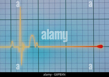 Flatline écho sur un moniteur cardiaque médical / ECG ECG (électrocardiogramme) avec fond bleu Banque D'Images