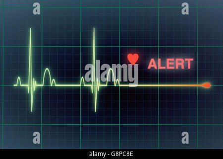 Battements cardiaques cardiogramme sur le moniteur Banque D'Images