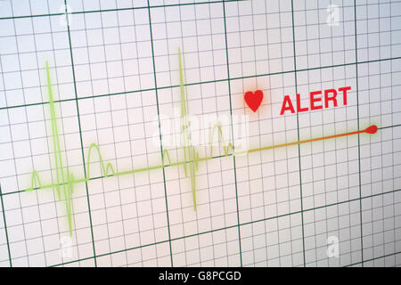 Battements cardiaques cardiogramme sur le moniteur Banque D'Images