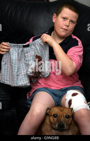 Adam Patrick Boyd, 10 ans, de West Denton à Newcastle, avec son taureau Terrier Staffordshire Tess (PAS le chien qui l'a attaqué), après avoir été attaqué par un chien de type Staffordshire. Banque D'Images