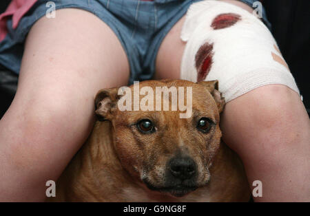 Adam Patrick Boyd, 10 ans, de West Denton à Newcastle, avec son taureau Terrier Staffordshire Tess (PAS le chien qui l'a attaqué), après avoir été attaqué par un chien de type Staffordshire. Banque D'Images