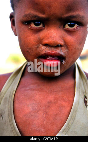 Une jeune fille attend une pompe à eau dans la ville miteuse de Matsakeng, près de Mafikeng, dans la province du Nord-Ouest, en Afrique du Sud.Il n'y a qu'une pompe pour un village de 1000. Banque D'Images