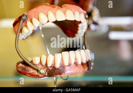 Zschadrass, Allemagne. 23 Juin, 2016. L'une des premières prothèses en caoutchouc avec les ressorts et les dents les dents en porcelaine datant de 1863 maintenant sur afficher dans le Musée dentaire de Zschadrass, Allemagne, 23 juin 2016. Le musée a pièces montrant l'existence de la médecine dentaire qui s'est jusqu'à 2500 ans. Il s'agit notamment des outils tels que des pincettes et la spatule de la période romaine, ainsi que des salles de traitement complet de l'époque de Frédéric le Grand, ou du "Buddenbrooks". Photo : Jan Woitas/dpa/Alamy Live News Banque D'Images