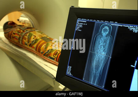 Une momie égyptienne de 3,000 ans se prépare à passer par un scanner pour voir ce qui se trouve à l'hôpital universitaire du centre de Londres. Banque D'Images