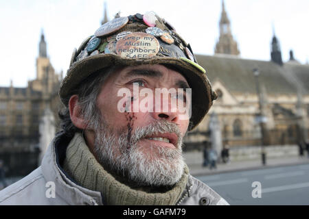 Brian Haw, militant pour la paix, Qui a été laissé avec des coupures au visage et au poignet après avoir été arrêté à l'extérieur de Downing Street lors d'une manifestation contre la loi sur le crime organisé et la police (Socpa) grave, se tient devant le Parlement un jour après qu'il aurait été agressé par un policier. Banque D'Images