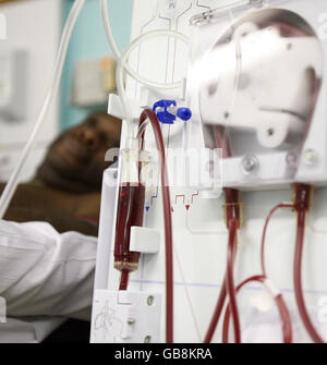 Noel Ashmead, patient rénal, reçoit un traitement sur appareil de dialyse à l'hôpital Guys de Londres. Banque D'Images